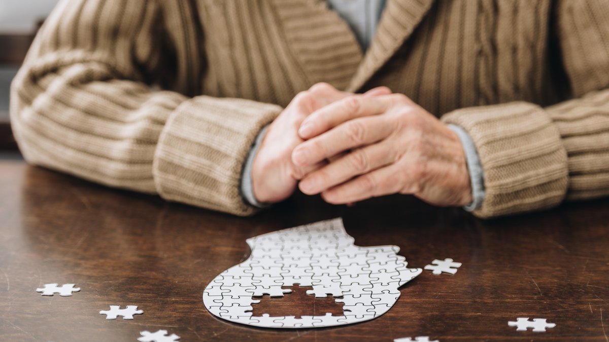 Frontotemporal Dementia Differential Diagnosis in Clinical Practice: A Single-Center Retrospective Review of Frontal Behavioral Referrals bit.ly/3YJnb4Y

#NeuroTwitter #NeuroX