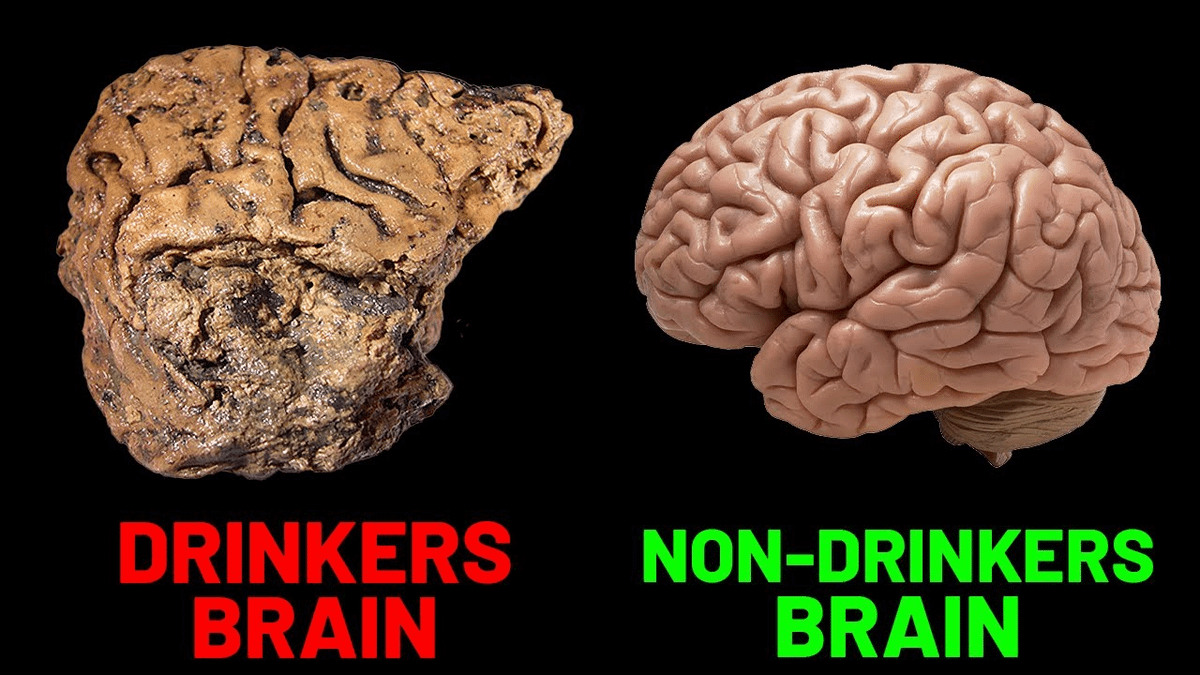 PropositoyVida's tweet photo. Cómo arreglar tu cerebro saturado de dopamina de forma permanente.

Este es el protocolo de 7 sencillos cambios en tu estilo de vida de Andrew Huberman para solucionarlo:

1) Deja de beber alcohol. https://t.co/FuC3QyDyVg