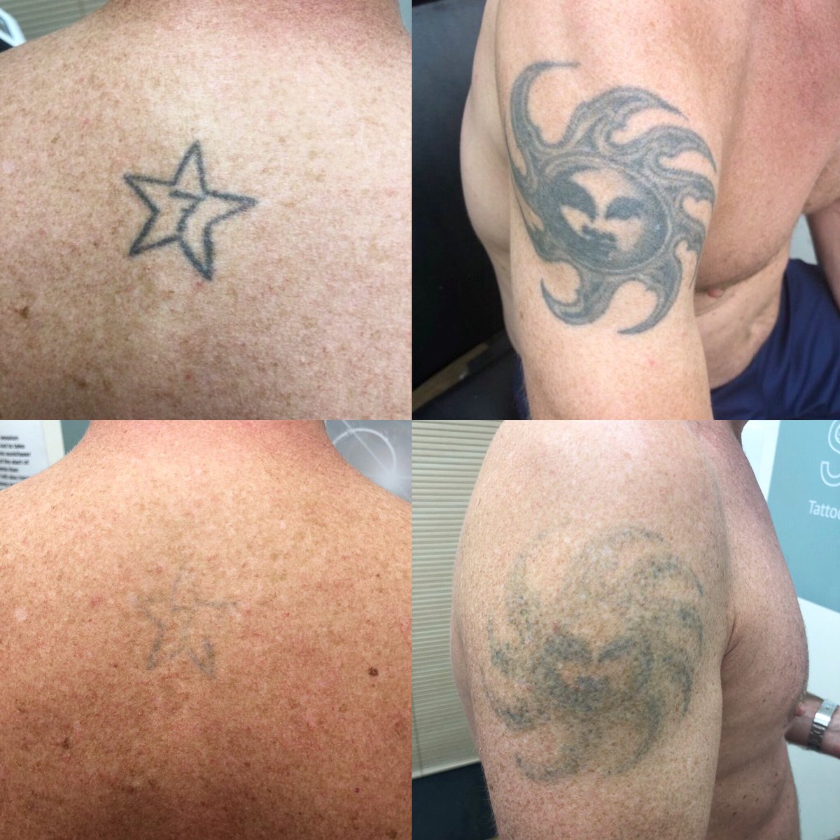 original_laser's tweet photo. Recent laser work https://t.co/qN5VA1Tt8H