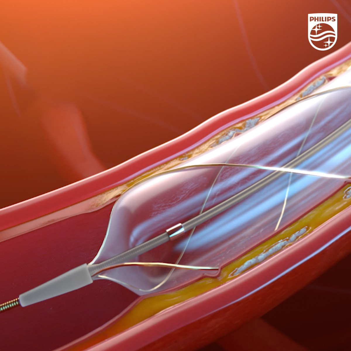 Philips Interventional Cardiology tweet media