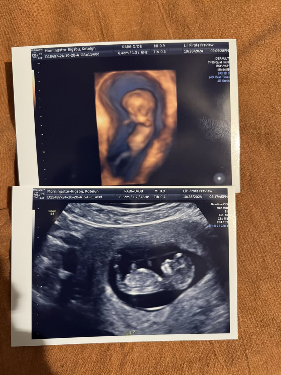 babykatesx's tweet photo. we having a baby or whateva https://t.co/oRXvq6ehFK