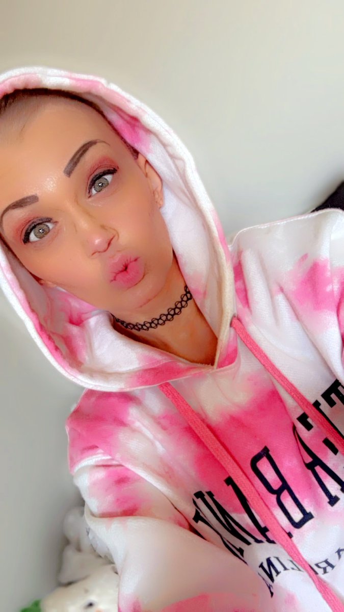 BeyoutifulAriii's tweet image. #nohairwhocares #baldgirl #loveyourself 💋