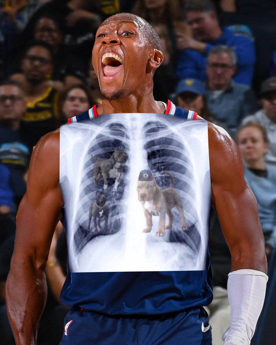 LAClippers's tweet photo. We found an X-Ray of Kristofer Michael Dunn 🐶 https://t.co/fFesB2ftx1