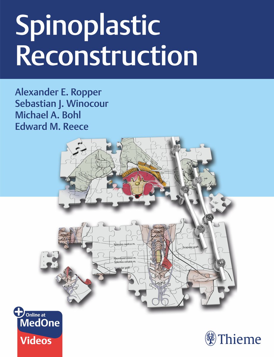 BCM Neurosurgery (@bcmneurosurgery) on Twitter photo In their new book, Spinoplastic Reconstruction, Dr. Alex Ropper (#BCMNeurosurgery), <a href="/WinocourMD/">Sebastian Winocour, MD, MBA, FACS</a> (Division of Plastic Surgery) et al. provide in-depth multidisciplinary discussion on optimizing complex bony and soft tissue reconstruction. #Spinoplastic
📘: tinyurl.com/y4tvtamv In their new book, Spinoplastic Reconstruction, Dr. Alex Ropper (#BCMNeurosurgery), <a href="/WinocourMD/">Sebastian Winocour, MD, MBA, FACS</a> (Division of Plastic Surgery) et al. provide in-depth multidisciplinary discussion on optimizing complex bony and soft tissue reconstruction. #Spinoplastic
📘: tinyurl.com/y4tvtamv