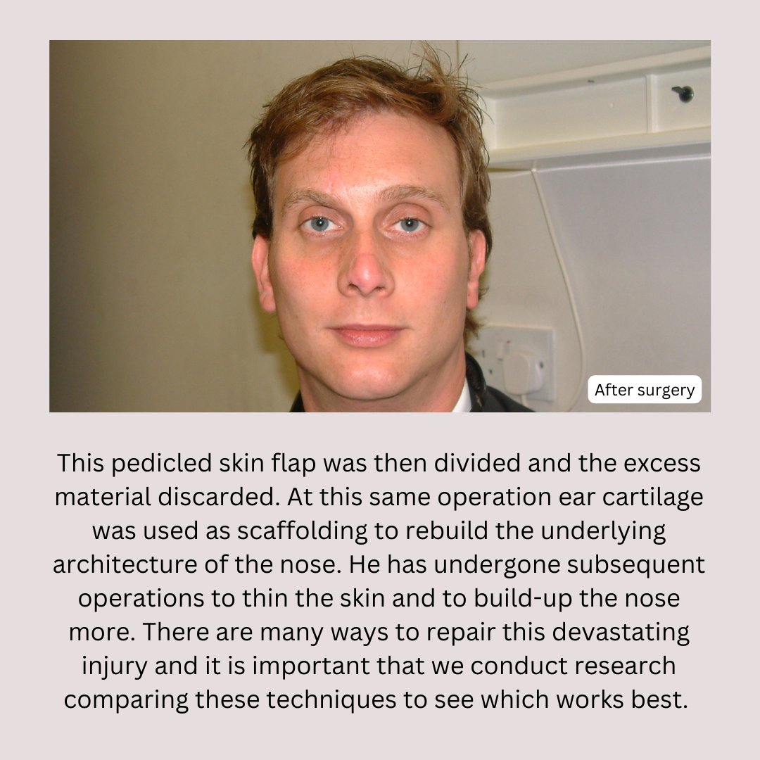 Saving Faces tweet media