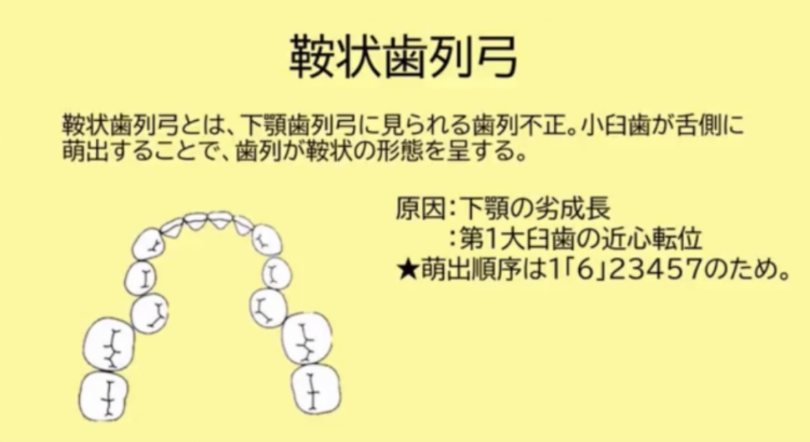 119回歯科医師国家試験対策 ロムニーハウス勉強会【講師 Dr.N