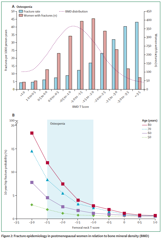 Although #fracture risk is often lower in #osteopenic women than in those with #osteoporosis, their greater number means that most fractures occur in osteopenic individuals thelancet.com/journals/landi…  
#osteopenia #BoneHealth