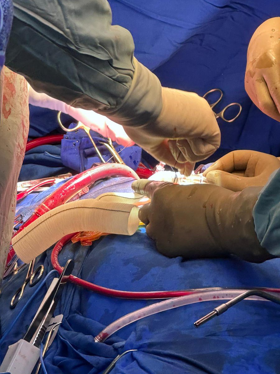 Miroslav P. Peev, MD FACS FACC tweet media