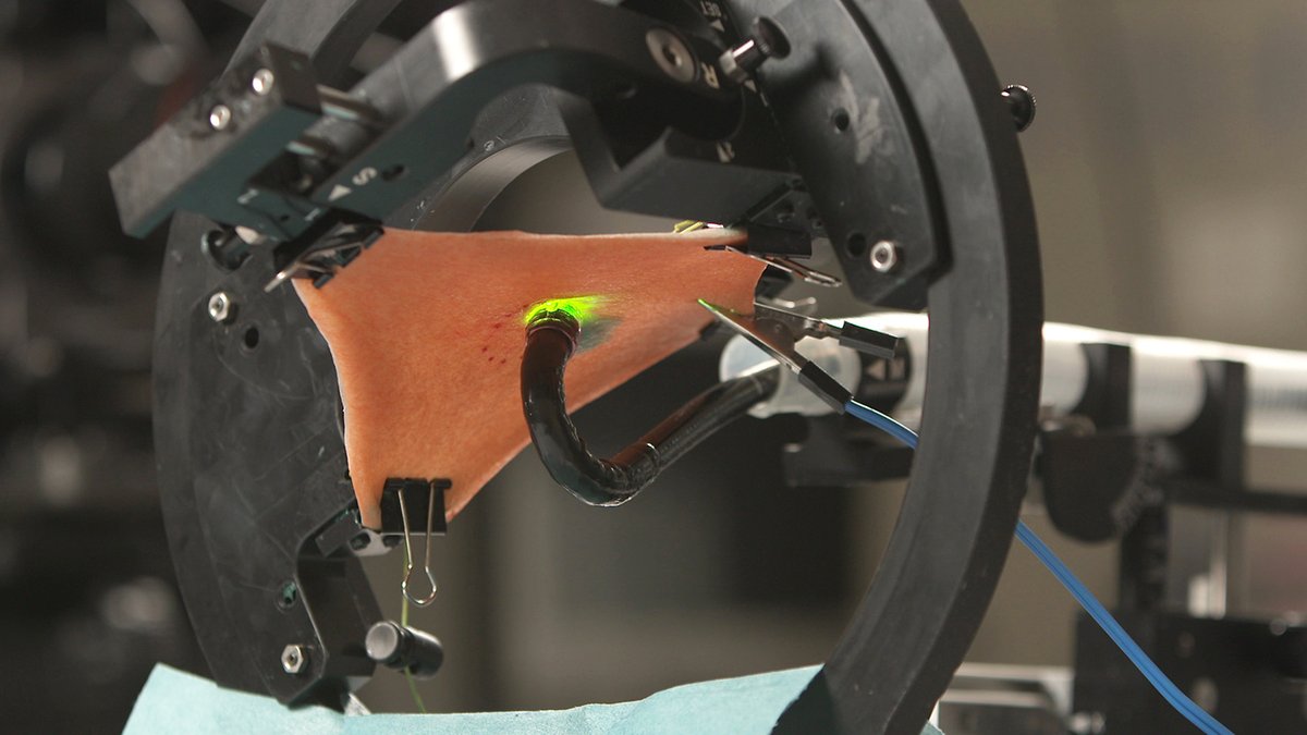 Our official setting video for the G-Master's gastric angulus position is now live on our YouTube channel! Check it out below for tips on how to optimize your use of the G-master during ESD practice for the gastric angulus.

youtube.com/watch?v=pTAVuG…

#esd #gastric