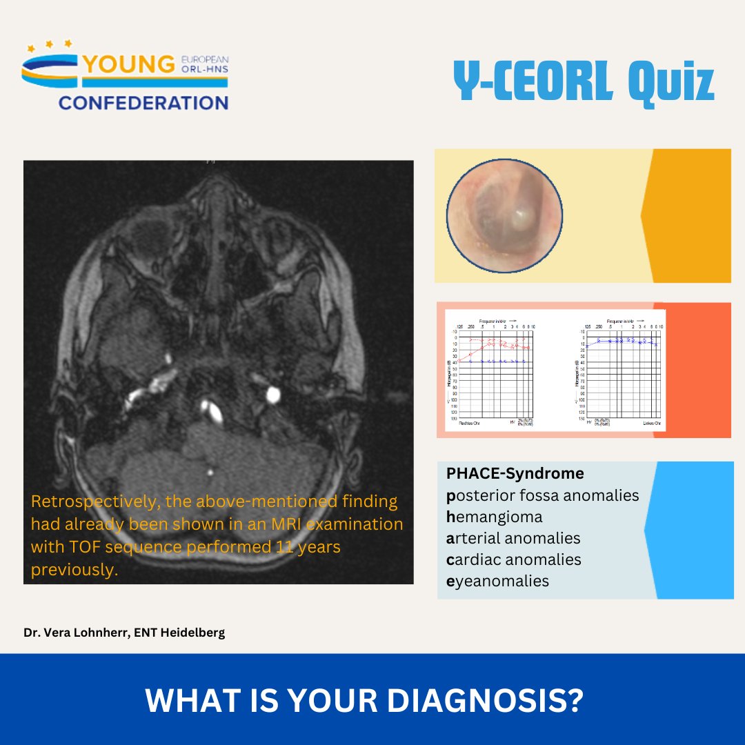🧠✨ Before we say goodbye to October, it's time for a quick challenge from the Young Confederation! Swipe through the slides to review the case and share your diagnosis in the comments below!
#CEORLHNS2024 #ENTProfessionals #CaseStudy #YoungConfederation