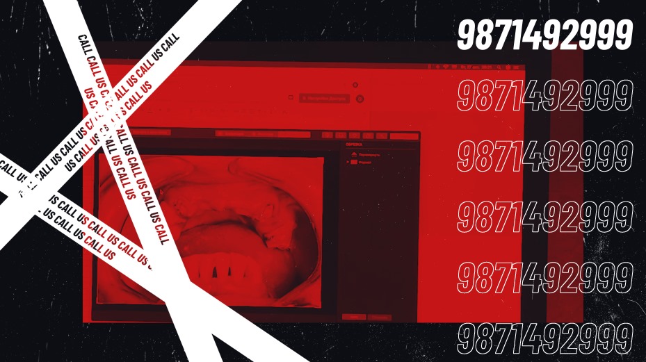 drsachetpopli's tweet image. FIXED TEETH IN 72HRS
CALL US TO BOOK YOUR APPINTMENT TODAY, LIMITED TIME OFFER OF 25%
@drpoplisdentalclinic

#dentalimplants #artificialteeth  #fixedteeth