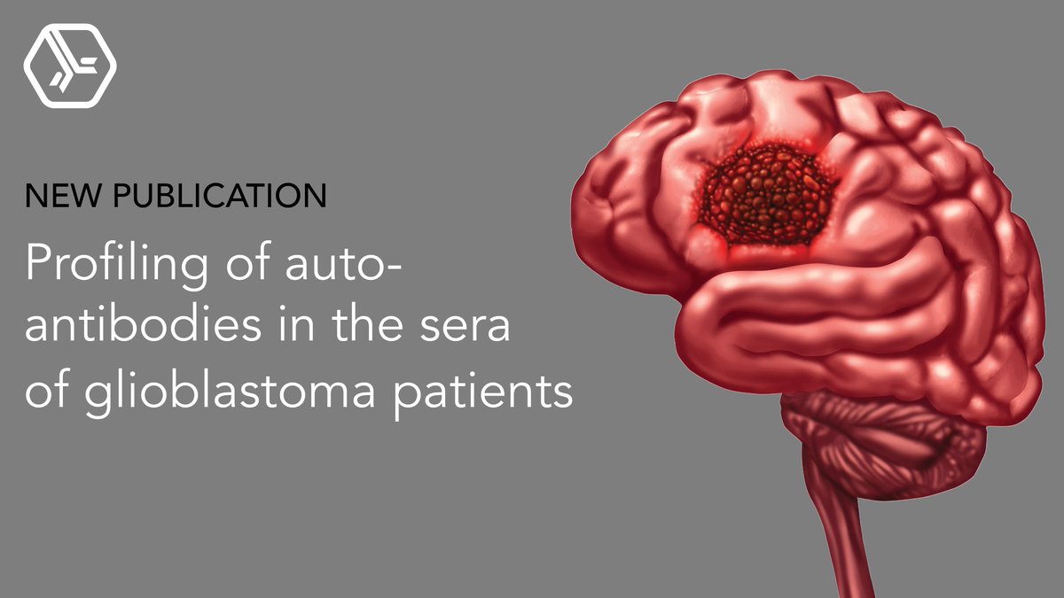 Dr. Abu and team <a href="/UKM_UMBI/">UMBI</a> identified differentially expressed autoantibodies as potential biomarkers in grade IV glioblastoma, leading to potentially new diagnostics or treatments.

🔗 Full study in <a href="/tandfonline/">Taylor & Francis Research Insights</a>: tandfonline.com/doi/full/10.10…

#CancerResearch #Glioblastoma #Biomarkers