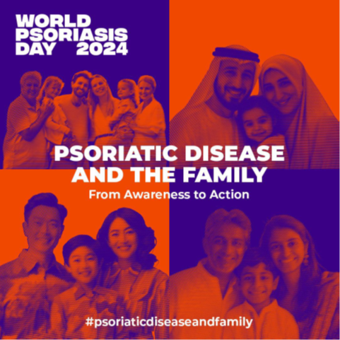 Today is World Psoriasis Day!
The theme for 2024 is #PsoriaticDisease and Family. Recognize the challenges faced by
individuals and their loved ones.
Learn more: ifpa-pso.com/world-psoriasi…
#psoriaticdiseaseandfamily #WorldPsoriasisDay2024