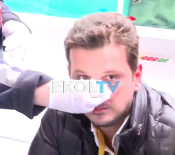 Atılan yumruk Beşiktaşlıların yumruğudur. Bir Beşiktaşlı çıktı ve malum yapının tasmalı köpekliğini yapmaya ant içmiş medya ayakçısına gerekeni ve yakışanı yaptı! Kendisiyle GURUR duyuyoruz! 

#SG
#GeçirenlerSağolsunEmreKaplan