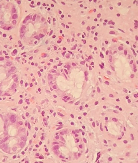 PH-choucroute 🌻 tweet media