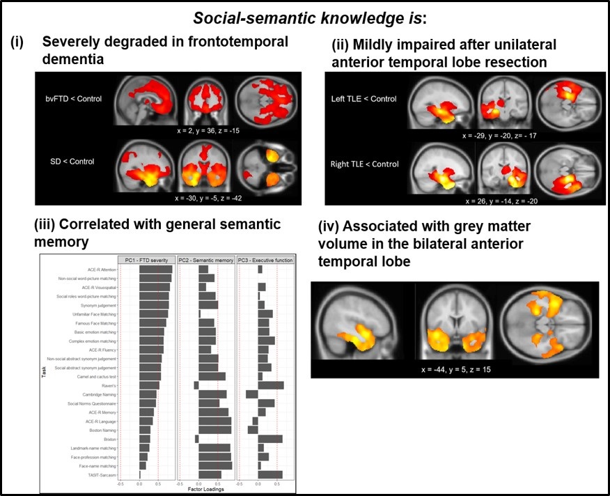 MRC Cognition and Brain Sciences Unit (@mrccbu) on Twitter photo New paper – Matt Rouse (<a href="/mattr19909/">Matthew Rouse</a>) and colleagues assembled a neuropsychological battery to explore social-semantic knowledge in #FTD and its relation to general conceptual knowledge:
doi.org/10.1093/brainc… New paper – Matt Rouse (<a href="/mattr19909/">Matthew Rouse</a>) and colleagues assembled a neuropsychological battery to explore social-semantic knowledge in #FTD and its relation to general conceptual knowledge:
doi.org/10.1093/brainc…