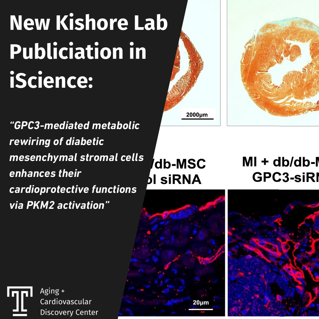 Kishore lab manuscript published in iScience! Study identifies a new target to improve diabetic mesenchymal stromal cell function and utilization for cardiac repair. 

cell.com/iscience/fullt…
