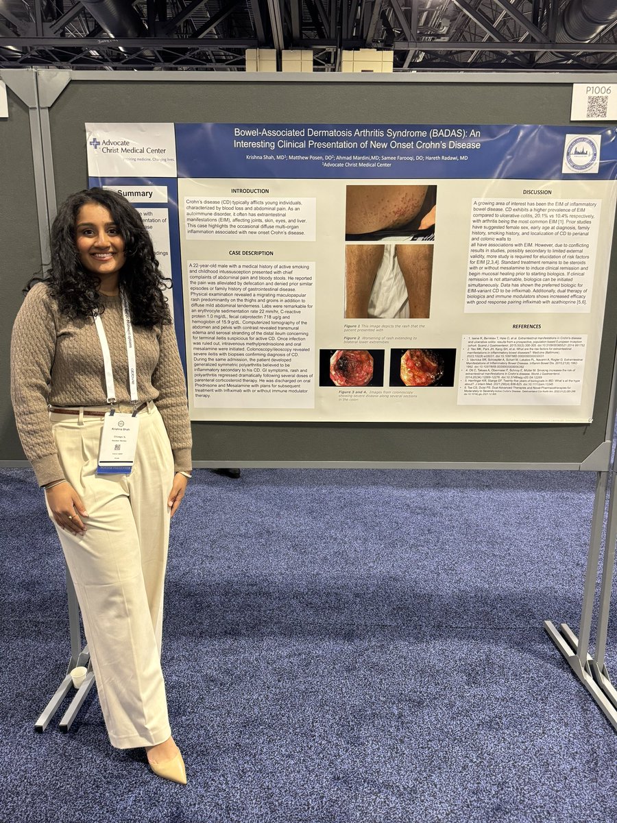 KrishnaDShah's tweet photo. First time presenting at @AmCollegeGastro !! 💩 ✅ https://t.co/xVNSHUWHUr