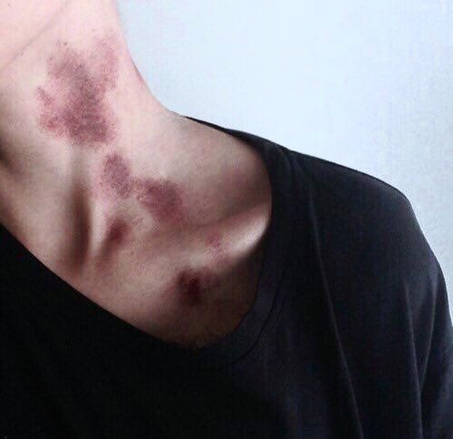 GR33KH3RO's tweet photo. how do you cover hickeys?...or get rid of them. https://t.co/ezLxnQZSev