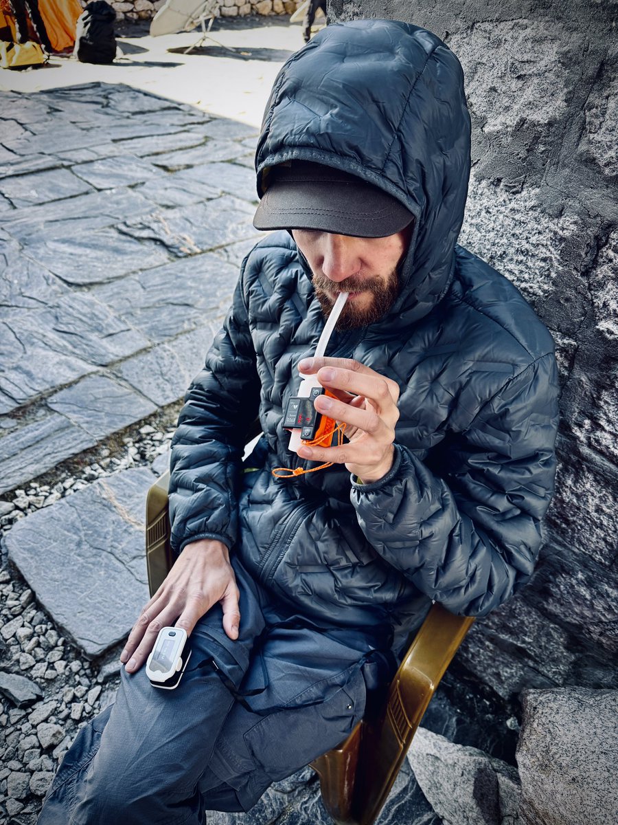 usgzrm's tweet photo. High altitude pulmonary edema after descending from Island Peak (6183m above sea level) Spo2 67%, etco2 - 17mmhg, #mountainsickness #hape https://t.co/v62WpoerxG