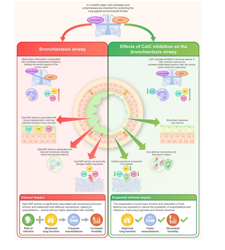 What is the role of neutrophilic inflammation in bronchiectasis? How do DPP1 inhibitors work and how might they help?

Everything you want to know about recent breakthroughs in BE just published in ERJ <a href="/ERSpublications/">ERS publications</a> <a href="/michalshteinber/">מיכל שטיינברג</a> <a href="/jeffxu118246/">Jin-fu Xu</a>
publications.ersnet.org/content/erj/ea…
