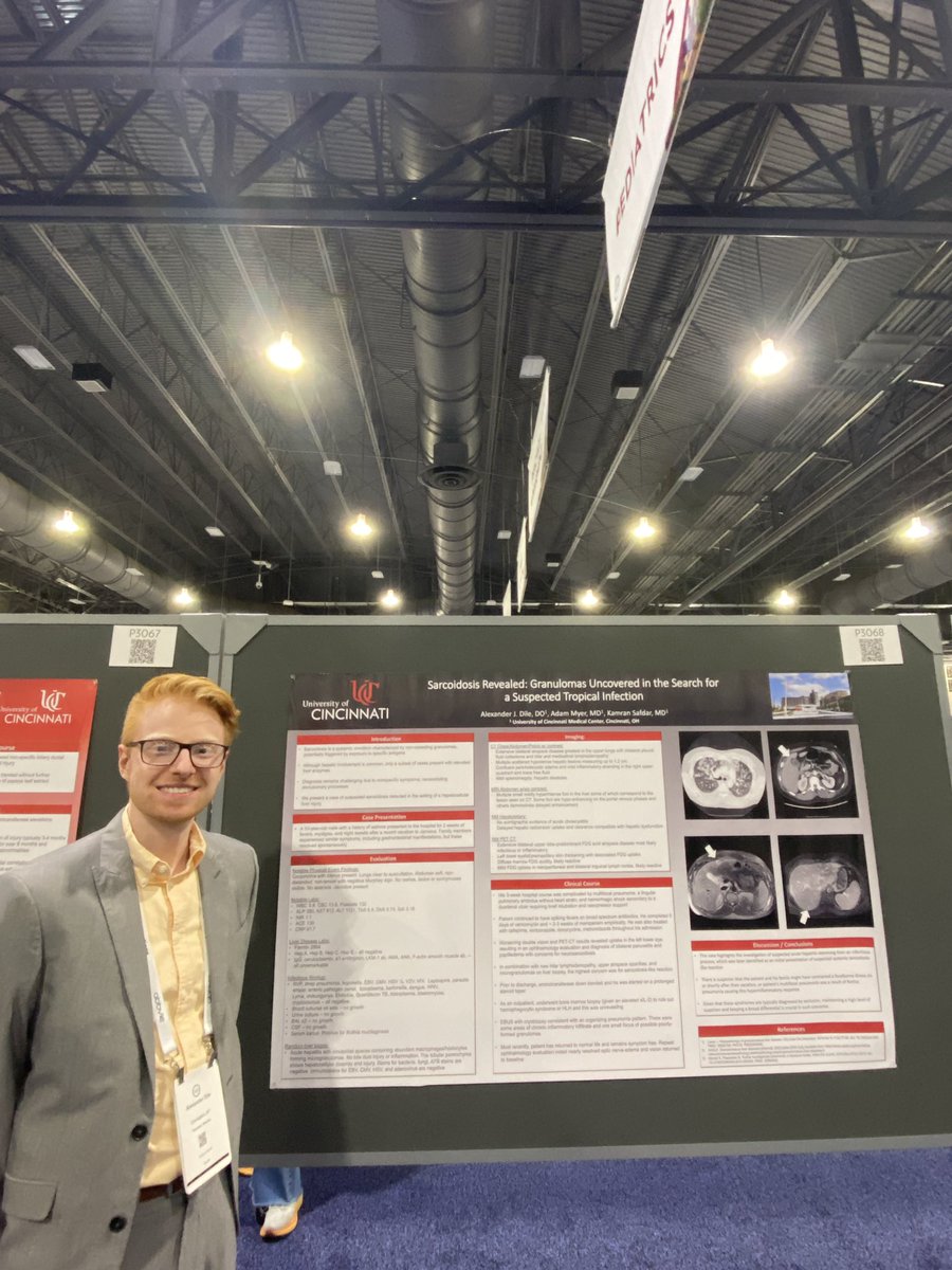 Great day of lectures and I’m honored to be awarded my first outstanding poster presenter distinction at #ACG2024
@UCincyIM <a href="/AmCollegeGastro/">ACG</a>