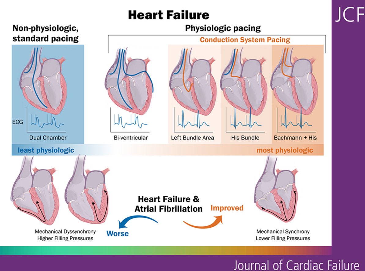 Robert Mentz, MD tweet media