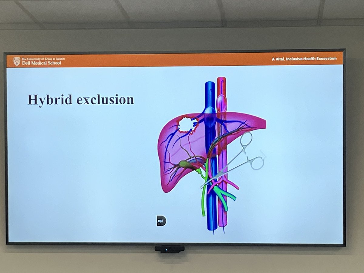 Dell Med Vascular Surgery (@dellmedvascular) on Twitter photo On Tuesdays we teach! This morning Dr. Joseph DuBose, our vascular & trauma surgeon extraordinaire, discussed intra-abdominal vascular injuries! What a great talk & discussion!
#VascSurg #SoMe4Surgery <a href="/pedrogrt/">Pedro Teixeira</a> On Tuesdays we teach! This morning Dr. Joseph DuBose, our vascular & trauma surgeon extraordinaire, discussed intra-abdominal vascular injuries! What a great talk & discussion!
#VascSurg #SoMe4Surgery <a href="/pedrogrt/">Pedro Teixeira</a>