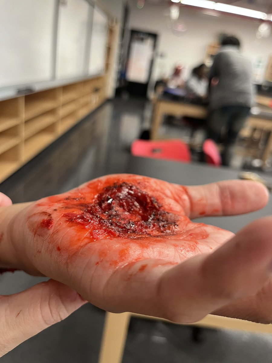 One of my favorite days with the besties! Learning all about wounds and how they heal while having a little Halloween fun.