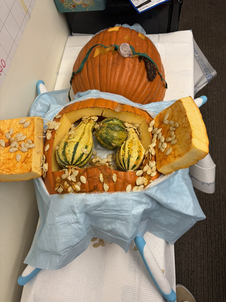 Erik Henricksen (@erik_henricksen) on Twitter photo Our patient had a long time on the waitlist being a highly sensitized blood type G (gourd), but we were finally able to get Jack to transplant!
<a href="/StanfordHealth/">Stanford Health Care</a> <a href="/StanfordCTSurg/">Stanford Cardiothoracic Surgery</a> <a href="/Stanford_HF/">Stanford Heart Failure, Cardiac Transplant and MCS</a> Our patient had a long time on the waitlist being a highly sensitized blood type G (gourd), but we were finally able to get Jack to transplant!
<a href="/StanfordHealth/">Stanford Health Care</a> <a href="/StanfordCTSurg/">Stanford Cardiothoracic Surgery</a> <a href="/Stanford_HF/">Stanford Heart Failure, Cardiac Transplant and MCS</a>