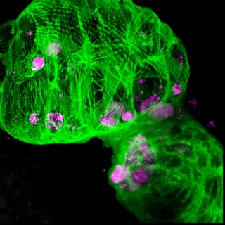 Phil Elks (@elkslab_sheff) on Twitter photo An exciting PhD opportunity in a great collaboration between <a href="/noelresearchlab/">Emily Noël</a> and my lab looking at heart infections in zebrafish. Details below. Deadline is the 13th December. findaphd.com/phds/project/m…. <a href="/BatesonCentre/">Bateson Centre</a> An exciting PhD opportunity in a great collaboration between <a href="/noelresearchlab/">Emily Noël</a> and my lab looking at heart infections in zebrafish. Details below. Deadline is the 13th December. findaphd.com/phds/project/m…. <a href="/BatesonCentre/">Bateson Centre</a>