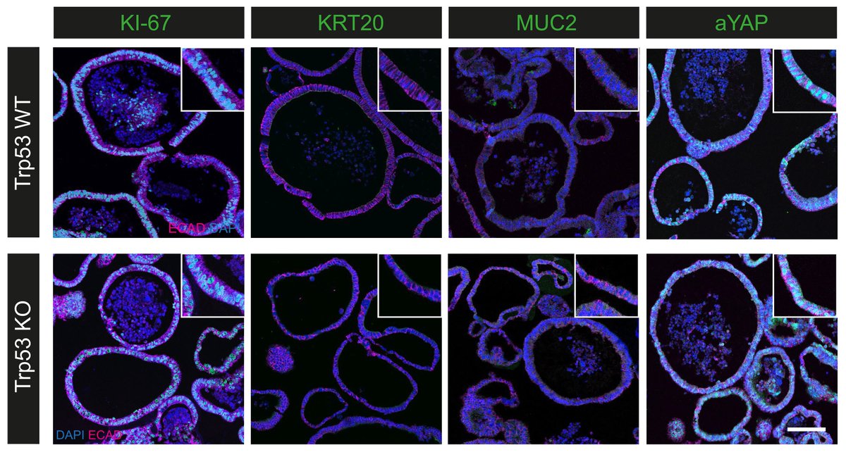 organoidscience's tweet image. Dr. @KimberlyHartl_ from @LabSigal at @ChariteBerlin led this study showing that p53 signaling is silent and dispensable during homeostasis but strongly up-regulated in the epithelium upon dextran sodium sulfate-induced #colitis. 🔬 

bit.ly/4e05J1X