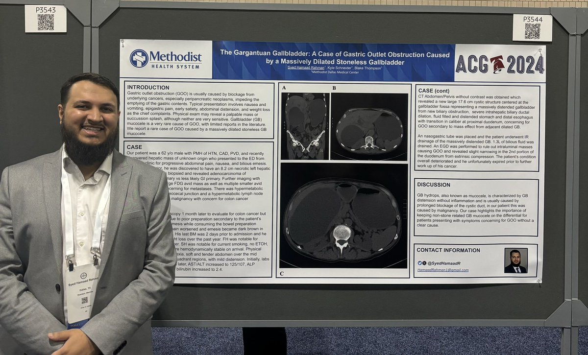 Syed Hamaad Rahman (@syedhamaadr) on Twitter photo Come check out my posters 📄 today at the exhibit hall today at #ACG2024 <a href="/AmCollegeGastro/">ACG</a>! I will be presenting between 1 and 2:15 PM
P4168
P3646
P4093
P3544 Come check out my posters 📄 today at the exhibit hall today at #ACG2024 <a href="/AmCollegeGastro/">ACG</a>! I will be presenting between 1 and 2:15 PM
P4168
P3646
P4093
P3544