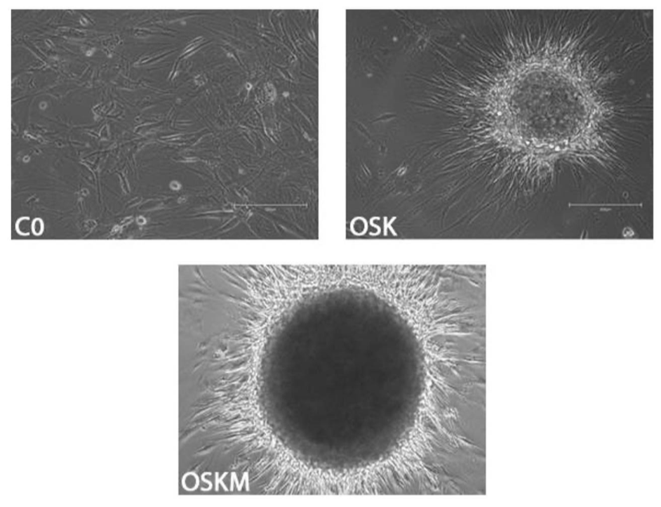 DrSamuelBHume's tweet photo. 3. Shift Bioscience: $16 million 

The Yamanaka factors (Oct3/4, Sox2, Klf4, and c-Myc: OSKM) can reverse epigenetic aging, but they also induce stem cell identity

Shift Bioscience have come up with alternative genes (C0), which reverse epigenetic age in fibroblasts but without forming stem cells (which would disrupt the cells' function):