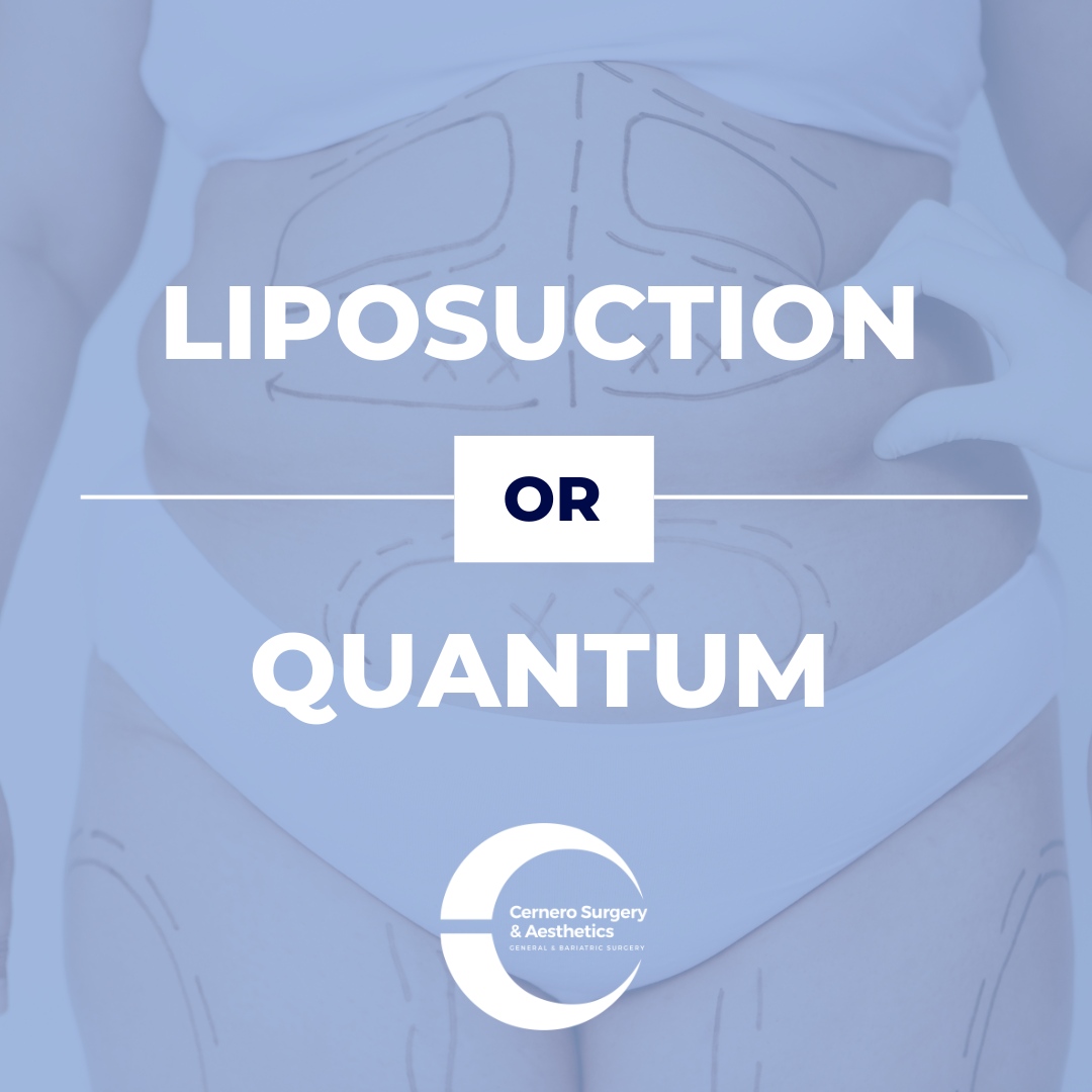 CerneroSurgery's tweet photo. Liposuction surgically removes fat from targeted areas, providing immediate dramatic results. Quantum uses a minimally invasive technique to deliver energy under the skin, tightening tissue and reducing fat without surgery. https://t.co/8wOIajOdg9 https://t.co/jQulTPBSyd