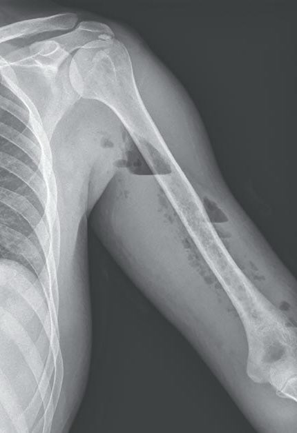 Oren Gottfried, MD tweet media