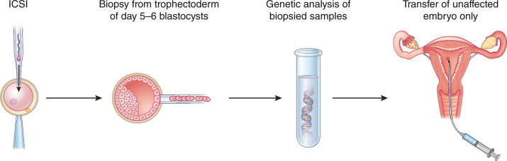 American Society of Pediatric Nephrology (@aspneph) on Twitter photo Prenatal and preimplantation testing for monogenic kidney disorders : a review
<a href="/Kidney_Int/">Kidney International</a>
ow.ly/MgnH50TVLPi Prenatal and preimplantation testing for monogenic kidney disorders : a review
<a href="/Kidney_Int/">Kidney International</a>
ow.ly/MgnH50TVLPi