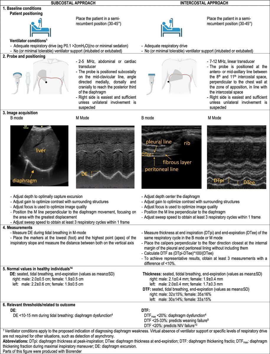 ZHeart11768530's tweet photo. 🔴How I perform diaphragmatic ultrasound in the intensive care unit⤵️ #2024Review #openaccess 

🔹Practical aspects of diaphragm ultrasound
🔹https://t.co/hQWtGjibf3
 #Cardiology #FOAMed #MedEd #medstudent #paramedic #Cardiology #CardioEd #medtwitter #meded #CardioTwitter https://t.co/fKCNOpXe49