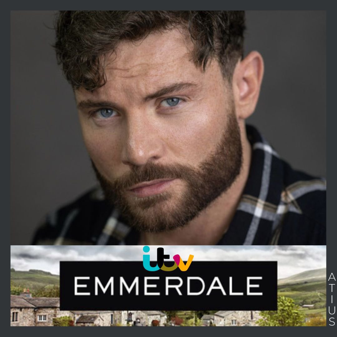 We are delighted to share the news that our brilliant Luke Delaney has been busy filming a major guest lead role on EMMERDALE which will hit our screens soon! 🎬🙌🏼