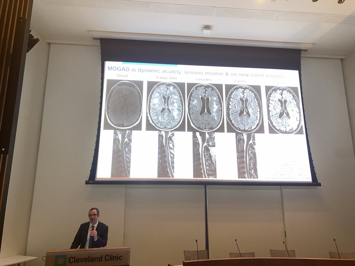 AKunchok's tweet photo. We were fortunate to have Dr @EoinFlanagan14  from @MayoClinicNeuro give grand rounds on #MOGAD @ClevelandClinic today! https://t.co/deo0SvRHzo