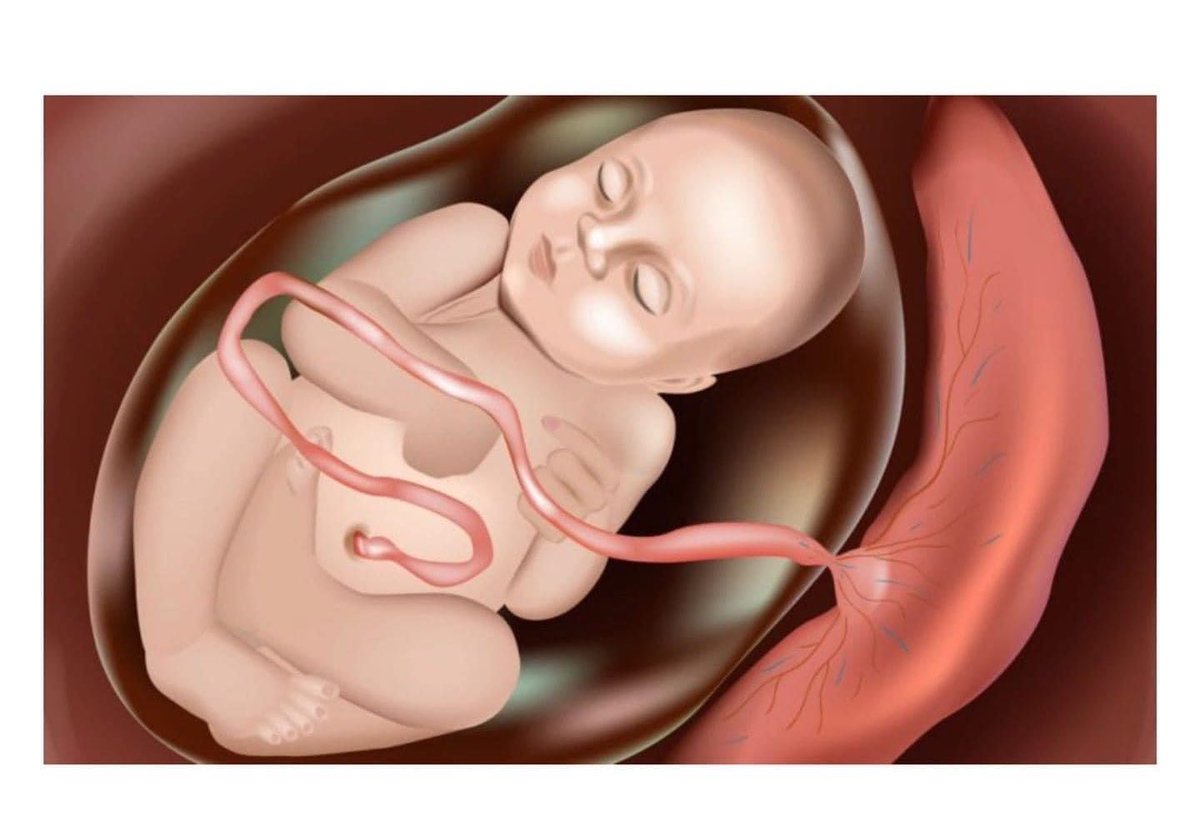 Anne karnındaki bir bebeğin ağzı, gözü, kulağı, eli, ayağı vardır. Halbuki bunların hiçbirine orada lüzum yoktur. Orada bebek, gıdasını göbeğinden annesine bağlı bir hortumla almaktadır.

Şimdi bu çocuk : 
Ya Rabbi şu hortum bana yetmektedir. Peki şu ağıza, göze, kulağa, ele,