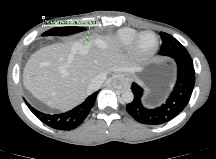 David Léon MD tweet media