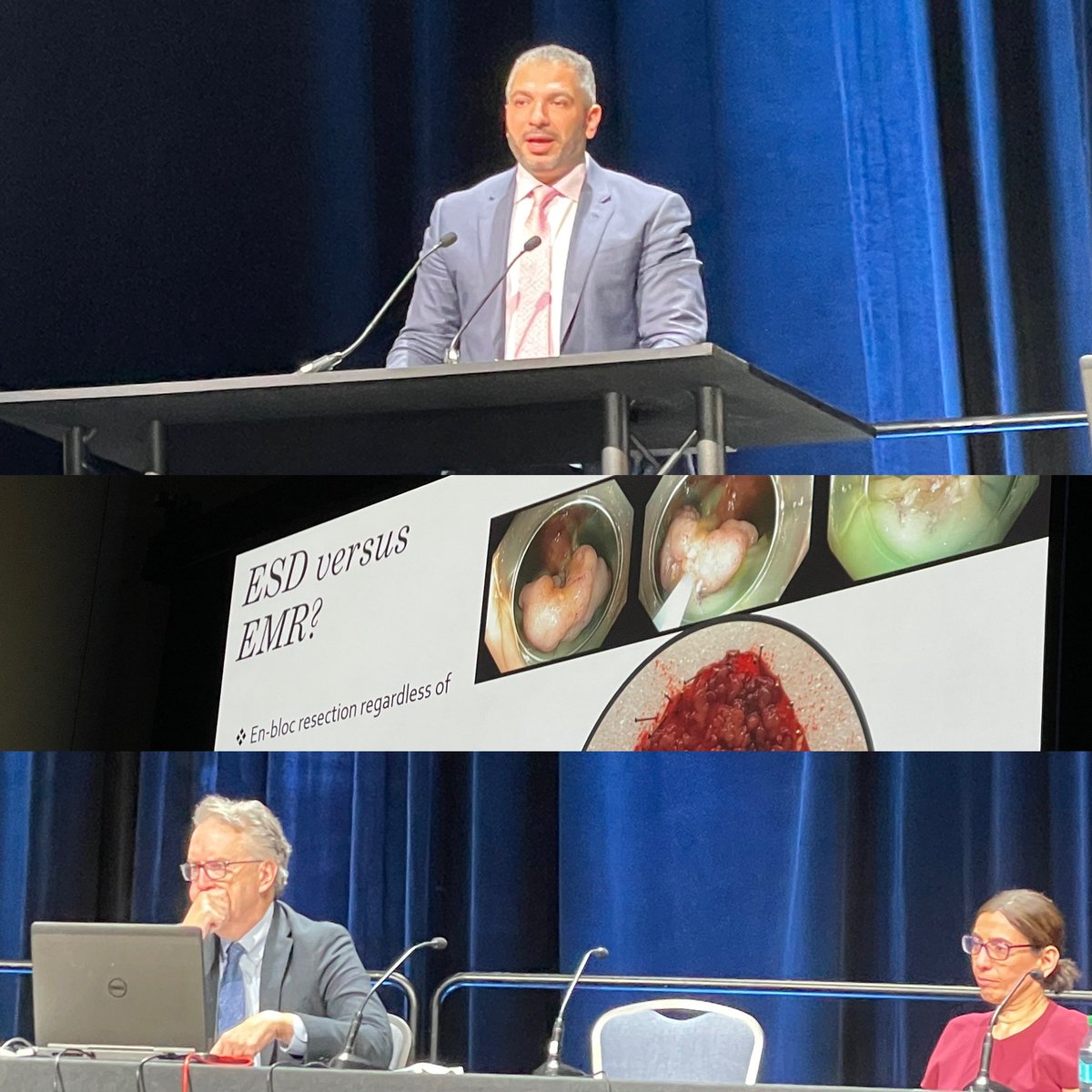 shifaumarMD's tweet image. #MasterClass on #ColonPolyps
Happening right now @AmCollegeGastro  
#ACG2024 

⭐️studded panel #DougRex #UzmaSiddiqui 

@EndoscopyOthman EMR vs ESD 🔪
⭕️Surgery vs Advanced Endoscopic resection 
⭕️Beyond the guidelines 
⭕️East 🤝 West perspective