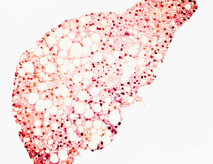 ScienceMagazine's tweet photo. Experiments in @SciSignal decode how ghrelin—also known as the “hunger hormone”—regulates the storage of fatty lipids in the liver and could potentially inform research into new targets in fatty liver disease. https://t.co/yWxC8AQaP3 https://t.co/g83qFt0OzQ