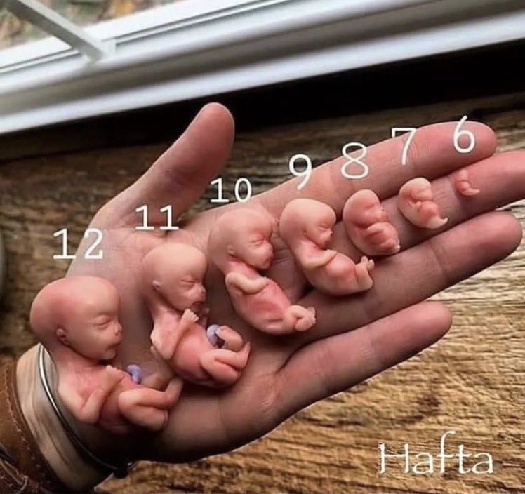 ¿De cuanto estas?
No importa el tamaño ni la edad, ya es humano, y esa es su forma. Cuidalo y querelo, no lo abortes, quiere vivir.