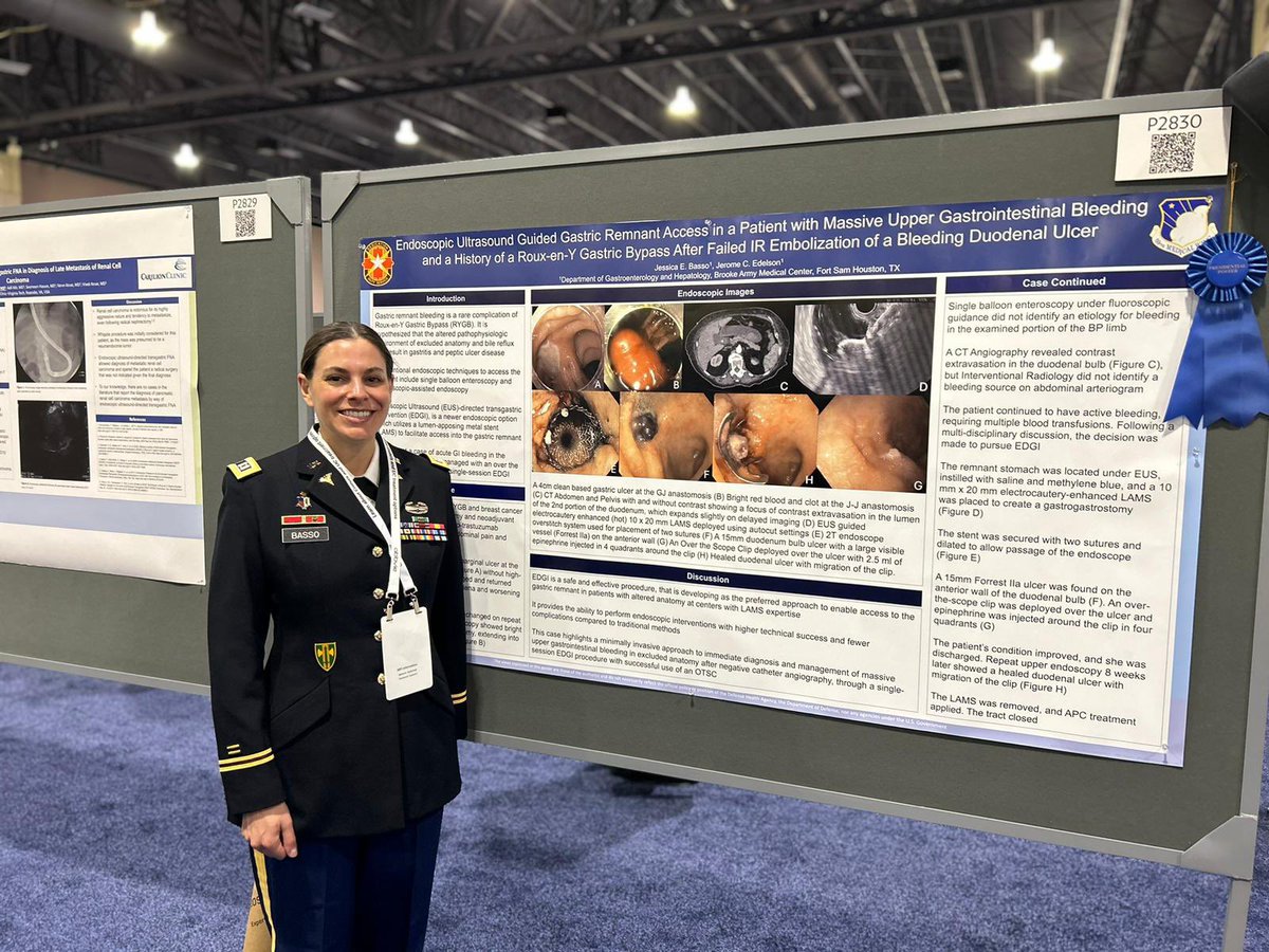 SAUSHEC Gastroenterology & Hepatology (@saushec_gi) on Twitter photo CPT Jess Basso at #ACG2024 CPT Jess Basso at #ACG2024