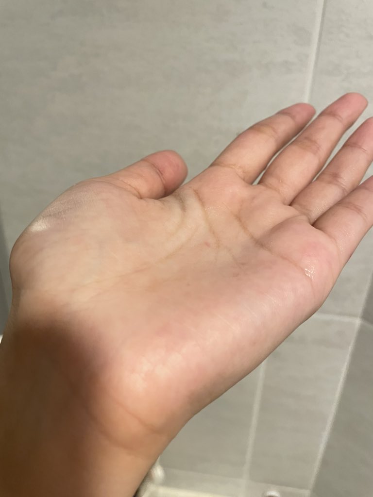 ffai_prc's tweet image. เริ่ดมากกับการเปลี่ยนโฟมล้างหน้าในรอบปี ใช้มา 7วันแล้ว บอกเลย NIVEA Derma Acne Care ผลลัพธ์เกินคาดมาก ผิวใสขึ้น รอยสิวจากลง ปิดสวิตซ์วงจรสิวให้ผิวมูฟออนจริง แถมหลังล้างหน้าผิวไม่แห้ง ล็อคความชุ่มชื้นสุดๆๆ สุดท้ายๆๆๆ ผิวแพ้ง่ายใช้ได้ด้วย อ่อนโยนกับผิวสุดๆๆ #Letsmoveon