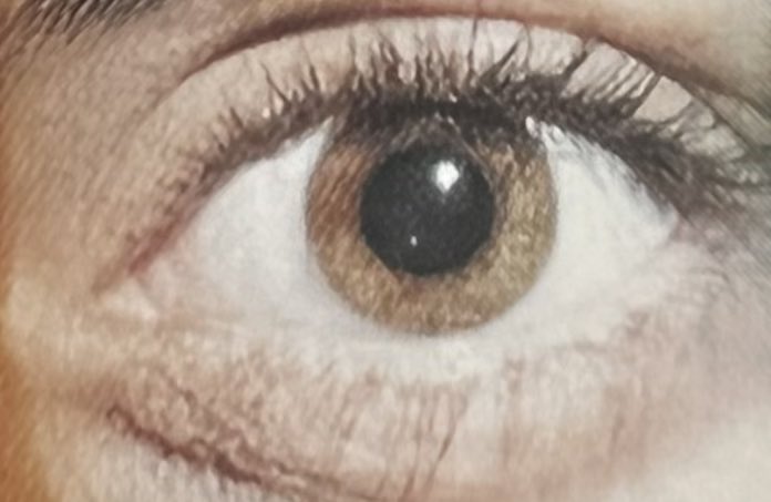 PfaefflDoc's tweet photo. #Risiko für #Erblindung ist bei #Frauen um 15% höher als bei Männern: #Glaukomanfall 3* #Schilddrüsen Morbus #Basedow
4* häufiger. [IRIS-Registry, weltgrösste Datenbank für Augenheilkunde] https://t.co/j1zBlnYnps