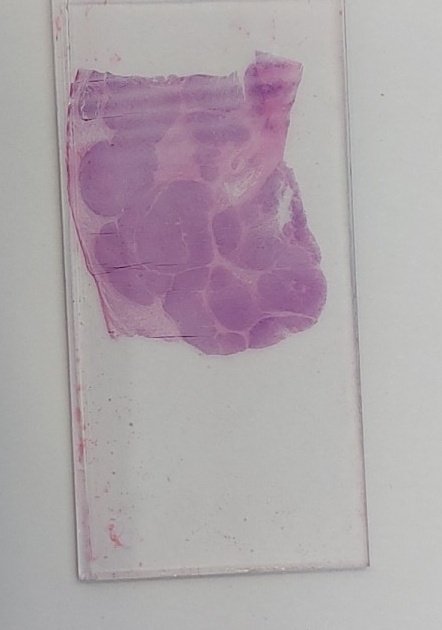 khalafalla71's tweet photo. #GUpathology https://t.co/ObvVC1duGP
