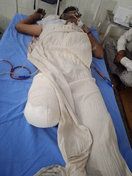 HideFace10's tweet photo. @rajrif_india Sir pls take imdt action this is serving soldier of 6 RAJ RIF soldier on leave was fired upon and then beaten and cut his leg .
@adgpi #IndianArmy #RajRif
https://t.co/H5Tta9uGti https://t.co/TWVYGJwyAp